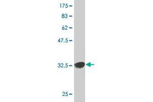 Western Blot detection against Immunogen (35. (RAD1 antibody  (AA 1-90))