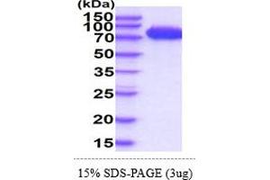 SDS-PAGE (SDS) image for Melanoma Cell Adhesion Molecule (MCAM) (AA 24-559) protein (His tag) (ABIN5855057)