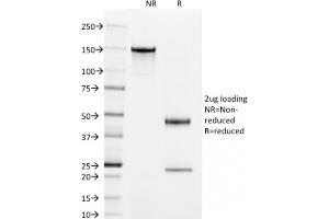 SDS-PAGE Analysis Purified CD55 Mouse Monoclonal Antibody (143-30). (CD55 antibody)