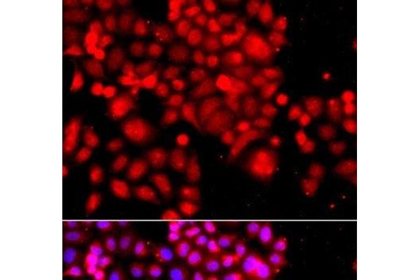 ASCC3 antibody