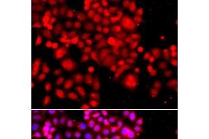Immunofluorescence analysis of A549 cells using ASCC3 Polyclonal Antibody (ASCC3 antibody)