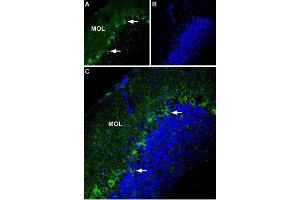 Expression of P2X1 Receptor in mouse cerebellum - Immunohistochemical staining of mouse cerebellum using Anti-P2X1 Receptor (extracellular) Antibody (ABIN7043571, ABIN7045096 and ABIN7045097).