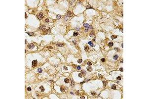 Immunohistochemical analysis of HUS1 staining in human kidney formalin fixed paraffin embedded tissue section. (HUS1 antibody)
