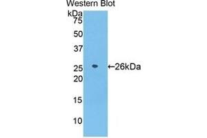 Detection of Recombinant AZU1, Human using Polyclonal Antibody to Azurocidin (AZU) (Azurocidin antibody  (AA 23-247))