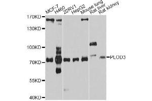 Western blot analysis of extracts of various cell lines, using PLOD3 antibody (ABIN5998540) at 1/1000 dilution.