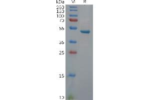 UCHL1 Protein (Fc Tag)