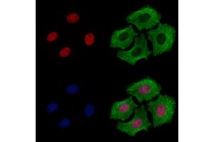 ABIN6260522 and ABIN6278786 staining Hela cells by IF/ICC. (CBX8 antibody  (Internal Region))