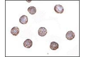 Immunocytochemistry of RNAse H2A in HeLa cells with this product at 2 μg/ml. (RNASEH2A antibody  (Center))