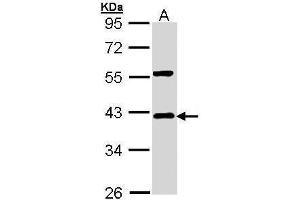 WB Image Sample (30 ug of whole cell lysate) A: Hep G2 , 10% SDS PAGE antibody diluted at 1:1000 (NFKBIA antibody  (Center))