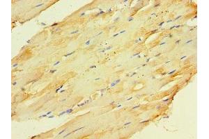 Immunohistochemistry of paraffin-embedded human skeletal muscle tissue using ABIN7148666 at dilution of 1:100 (CKMT2 antibody  (AA 40-230))