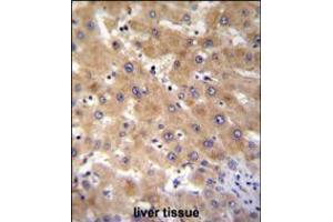 GAGE12B Antibody immunohistochemistry analysis in formalin fixed and paraffin embedded human liver tissue followed by peroxidase conjugation of the secondary antibody and DAB staining. (G Antigen 12B antibody  (N-Term))