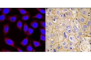 Image no. 2 for anti-Platelet Derived Growth Factor Receptor alpha (PDGFRA) (Tyr754) antibody (ABIN359914) (PDGFRA antibody  (Tyr754))