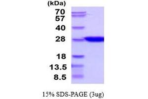 SDS-PAGE (SDS) image for Ciliary Neurotrophic Factor (CNTF) (AA 1-200) (Active) protein (His tag) (ABIN6387905)