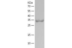 Western Blotting (WB) image for Glutathione Peroxidase 3 (Plasma) (GPX3) (AA 100-172) protein (His-IF2DI Tag) (ABIN7123129) (GPX3 Protein (AA 100-172) (His-IF2DI Tag))