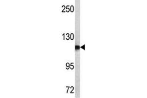 Western blot analysis of NPEPPS antibody and MCF-7 lysate. (NPEPPS antibody  (AA 709-737))
