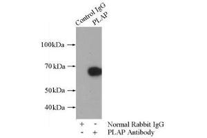 IP analysis of HepG2 cell lysates (1800 μg), using PLAP antibody (1/800 dilution).