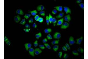 Immunofluorescence staining of Hela cells with ABIN7142862 at 1:133, counter-stained with DAPI. (INPP5E antibody  (AA 1-133))