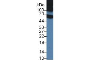 Western Blot; Sample: Rat Serum; Primary Ab: 1µg/ml Rabbit Anti-Rat ITIH1 Antibody Second Ab: 0. (ITIH1 antibody  (AA 412-664))