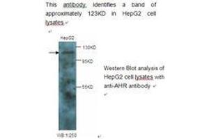 Image no. 1 for anti-Aryl Hydrocarbon Receptor (AHR) antibody (ABIN790782) (Aryl Hydrocarbon Receptor antibody)