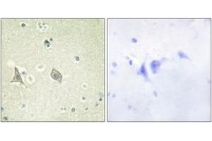 Immunohistochemistry analysis of paraffin-embedded human brain, using M-CSF Receptor (Phospho-Tyr723) Antibody. (CSF1R antibody  (pTyr723))