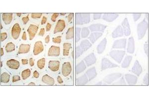 Immunohistochemistry analysis of paraffin-embedded human skeletal muscle tissue, using Actinin alpha-2/3 Antibody. (ACTN2/3 antibody  (AA 31-80))