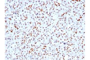 Formalin-fixed, paraffin-embedded human Pancreas stained with SOX9 Recombinant Rabbit Monoclonal Antibody (SOX9/3141R). (Recombinant SOX9 antibody  (AA 393-508))
