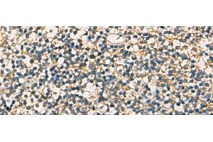 Immunohistochemistry of paraffin-embedded Human tonsil tissue using STX6 Polyclonal Antibody at dilution of 1:60(x200) (Syntaxin 6 antibody)