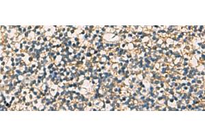 Immunohistochemistry of paraffin-embedded Human tonsil tissue using STX6 Polyclonal Antibody at dilution of 1:60(x200)
