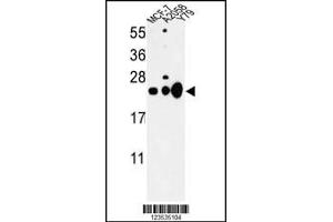 Western blot analysis of CBX1 Antibody in MCF-7, A2058, Y79 cell line lysates (35ug/lane) (CBX1 antibody  (C-Term))