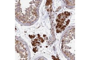 Immunohistochemical staining of human testis with OR14J1 polyclonal antibody  shows strong cytoplasmic positivity in Leydig cells at 1:20-1:50 dilution. (OR14J1 antibody)