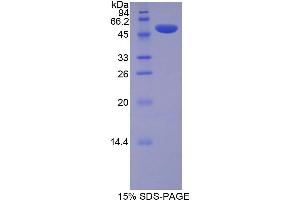 SDS-PAGE (SDS) image for Lysyl Oxidase (LOX) (AA 207-411) protein (His tag,GST tag) (ABIN2123209)