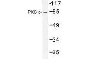 Western blot analysis of PKC ε antibody in extracts from HeLa cells. (PKC epsilon antibody)