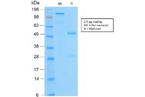 SDS-PAGE Analysis of Purified BCL2 Rabbit Recombinant Monoclonal Antibody ABIN6383843. (Recombinant Bcl-2 antibody)