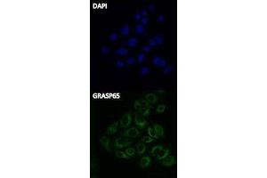 Immunofluorescence (IF) image for Donkey anti-Rabbit IgG antibody (FITC) (ABIN2667148) (Donkey anti-Rabbit IgG Antibody (FITC))