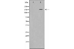 Western blot analysis of c-Met expression in HepG2 whole cell lysates,The lane on the left is treated with the antigen-specific peptide. (c-MET antibody  (Internal Region))