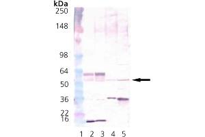 Western Blot Analysis of CaMKII: Lane 1: MWM, Lane 2: Brain (mouse), (tissue extract)  Lane 3:Brain (rat), (tissue extract)  Lane 4: HeLa, (cell lysate)  Lane 5: Hs-67 cell lysate. (CAMK2A antibody  (N-Term))