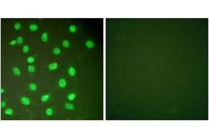 Immunofluorescence analysis of HepG2 cells, using MCM2 Antibody. (MCM2 antibody  (AA 1-50))