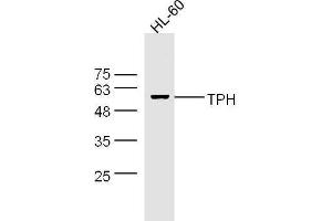 HL-60 cell lysates probed with Rabbit Anti-Trptophan Hydroxylase Polyclonal Antibody, Unconjugated  at 1:500 for 90 min at 37˚C. (Trptophan Hydroxylase (AA 31-150) antibody)