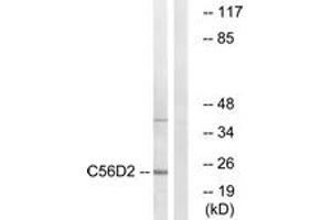 Western Blotting (WB) image for anti-Cytochrome B-561 Domain Containing 2 (CYB561D2) (AA 55-104) antibody (ABIN2889870) (CYB561D2 antibody  (AA 55-104))