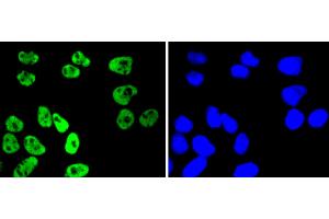 HeLa cells were stained with MSK1 (Ser376) (11A1) Monoclonal Antibody  at [1:200] incubated overnight at 4C, followed by secondary antibody incubation, DAPI staining of the nuclei and detection. (MSK1 antibody  (pSer376))