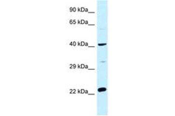 CCDC68 anticorps  (AA 121-170)