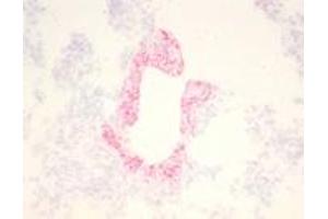 Immunohistochemical staining (Frozen Sections) of RSV-infected lung tissue (Guinea pig) (RSV antibody)
