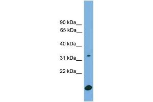 WB Suggested Anti-RAB9A Antibody Titration:  0. (RAB9A antibody  (Middle Region))