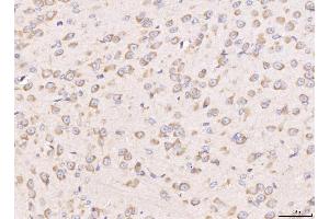 IHC analysis of RPL29 using anti-RPL29 antibody (ABIN7600993). (RPL29 antibody  (AA 27-153))