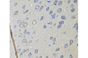 Immunohistochemistry of paraffin-embedded Rat brain using CDH16 Polyclonal Antibody at dilution of 1:100 (40x lens). (Cadherin-16 antibody)