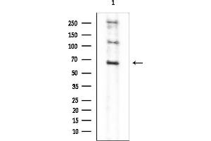 anti-Suppression of Tumorigenicity 7 (ST7) antibody