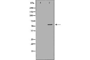 Western blot analysis of Hela whole cell lysates, using AIRE Antibody. (AIRE antibody  (Internal Region))