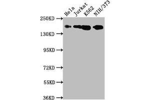Western Blot Positive WB detected in: Hela whole cell lysate, Jurkat whole cell lysate, K562 whole cell lysate, NIH/3T3 whole cell lysate All lanes: TOP2A antibody at 1:1500 Secondary Goat polyclonal to rabbit IgG at 1/50000 dilution Predicted band size: 175, 178, 179, 183 kDa Observed band size: 175 kDa (Recombinant Topoisomerase II alpha antibody)