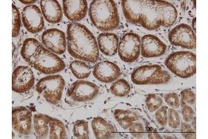 Immunoperoxidase of monoclonal antibody to PAK1 on formalin-fixed paraffin-embedded human stomach. (PAK1 antibody  (AA 191-280))