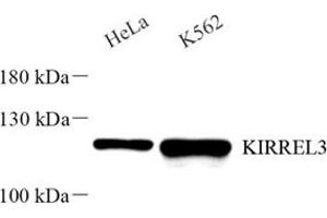 Western blot analysis of KIRREL3 (ABIN7074434) at dilution of 1: 2000